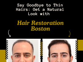 Say-Goodbye-to-Thin-Hairs-Get-a-Natural-Look-with-Hair-Restoration-Boston