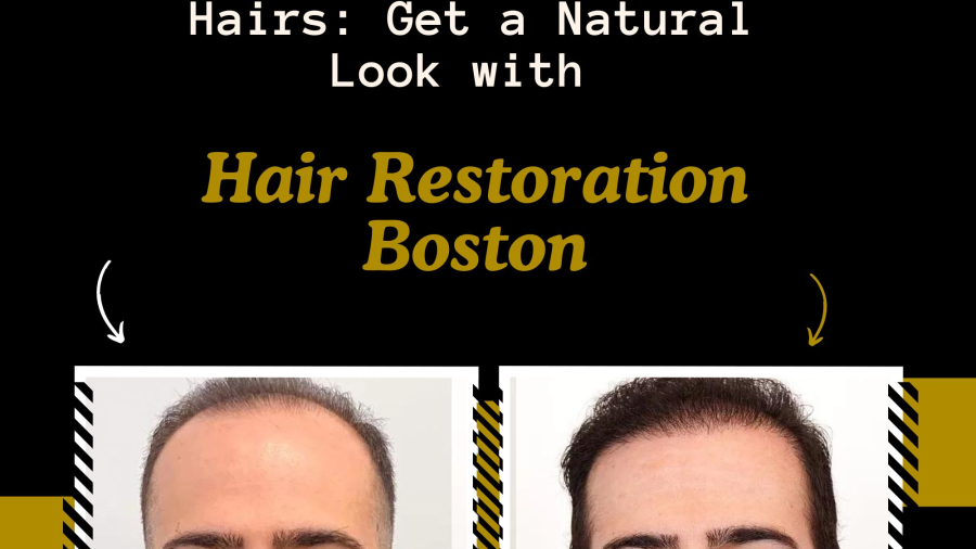 Say-Goodbye-to-Thin-Hairs-Get-a-Natural-Look-with-Hair-Restoration-Boston