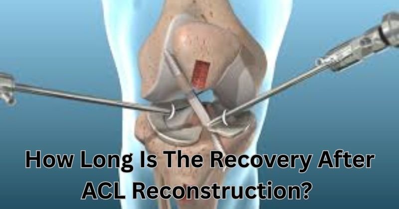 ACL-Reconstruction