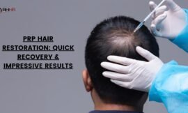 PRP Hair Restoration: Quick Recovery & Impressive Results